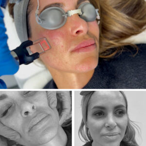 DOPAMINE BEAUTY: Regenera y perfecciona con exosomas