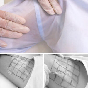 STOP EXCESO DE SUDOR: El infalible contra la hiperhidrosis