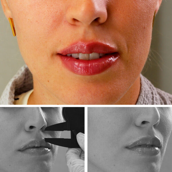 DISEÑO DE LABIOS