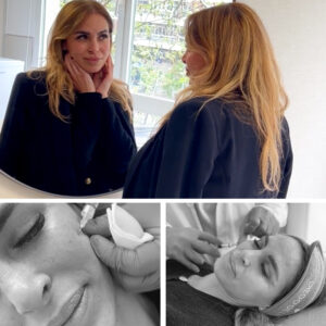 GLOW UP · Polinucleótidos: Tu piel en su máximo esplendor