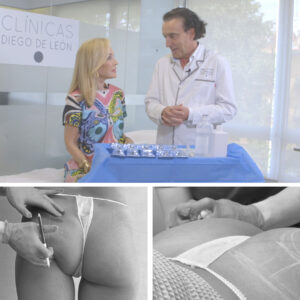 diseño-gluteos-clinicas-diego-de-leon